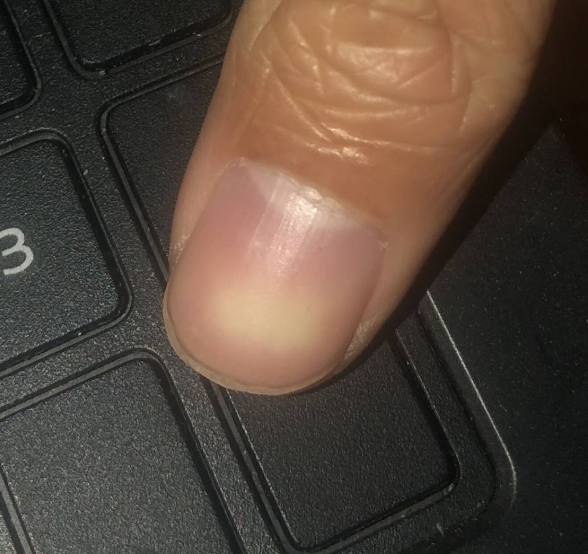 1638262793116573.png image.png