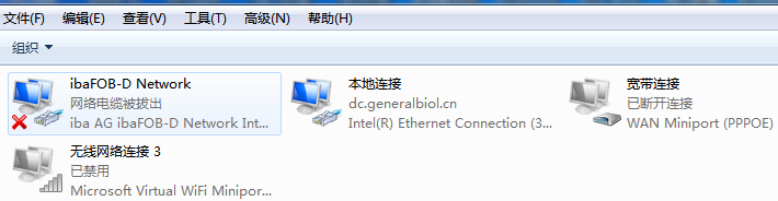 電腦本地連接在哪